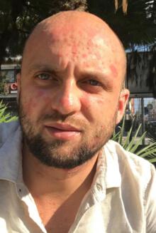 Łukasz Matusik przed terapią